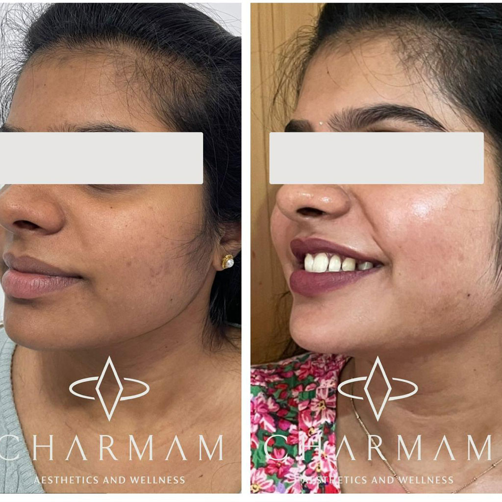 Skin Brightening Protocol
