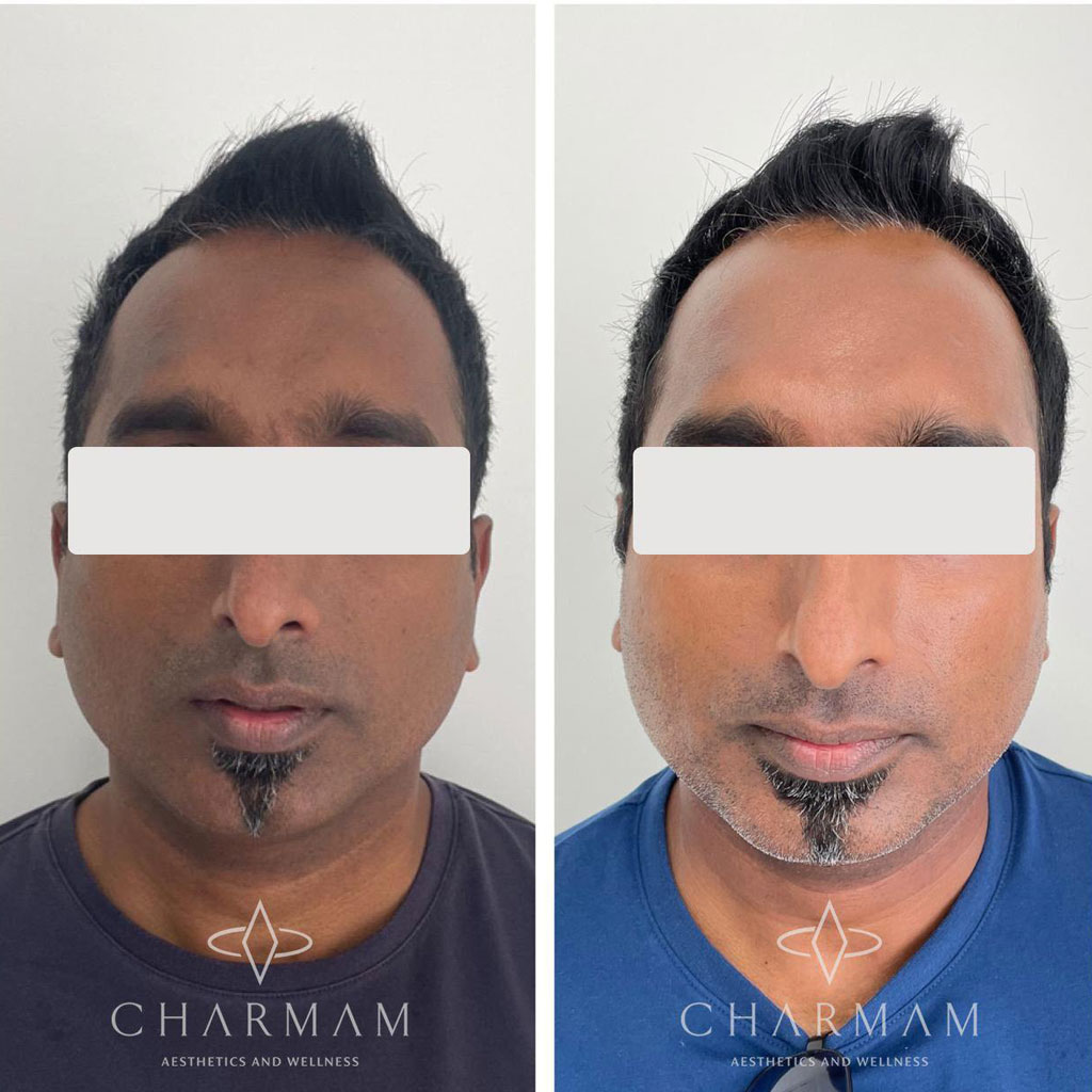 Men’s Pigmentation Protocol